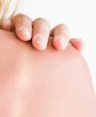 TikTok'un yeni trendi 'güneş yanığı' kanser riskini artırabilir