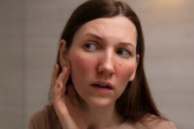 Uzmanı açıkladı Bu belirtiye dikkat Sosyal anksiyete bozukluğu olabilir!