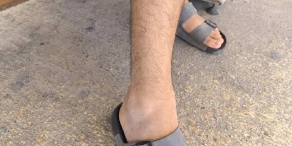 Bursa’da duş alırken akrep soktu!