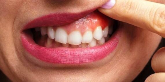 Dişleriniz vücudunuzu nasıl etkiliyor? Uzmanı açıkladı: Dişlerin genel sağlığa 5 etkisi…