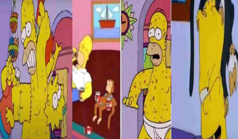 The Simpsons kehanetleri Maymun Çiçeği Virüsünü de tahmin etti mi?