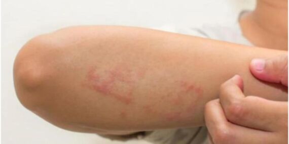 Alışveriş sonrası kabus: Yıkanmamış kıyafetler hangi tehlikeleri barındırıyor?