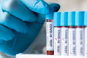 50 yıl sonra yeni bir kan grubu keşfedildi MAL