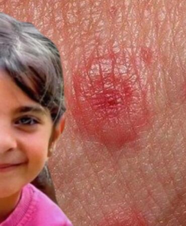 Narin Güran'ın otopsi işlemi tamamlandı! Peki lezyon nedir Lezyon nasıl oluşur