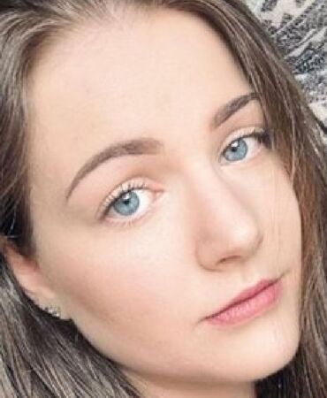 down sendromlu 23 yaşında