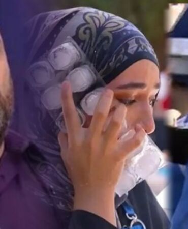 MasterChef Türkiye’de üzücü kaza Somer şef, yaralanan Beyza’nın dağlık durumunu açıkladı