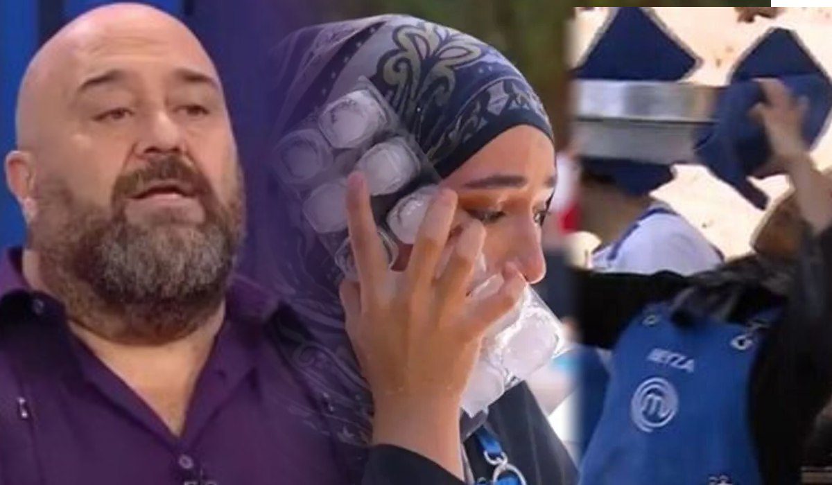 MasterChef Türkiye’de üzücü kaza Somer şef, yaralanan Beyza’nın dağlık durumunu açıkladı