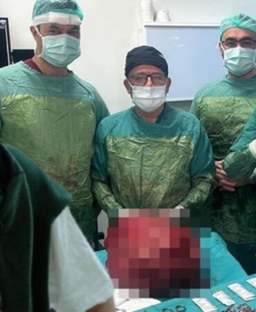 Karnından 13 kiloluk kitle çıkarıldı 'Dünyaya yeniden gelmiş gibiyim