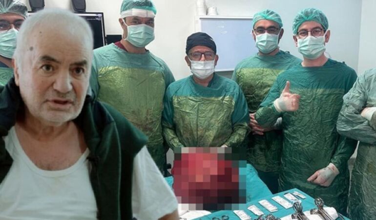 Karnından 13 kiloluk kitle çıkarıldı 'Dünyaya yeniden gelmiş gibiyim