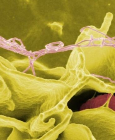 İzmir'de salmonella alarmı '48 saate kadar üreyebilir'