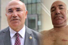 CHP Şanlıurfa Milletvekili Mahmut Tanal'a polis şiddeti! 'Sadece bedende değil...'