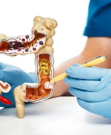 Haftada en az üç gün tüketin! Kolon kanseri riskini azaltıyor
