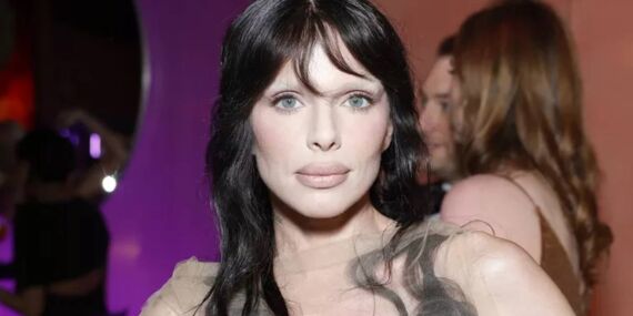 2025 Vanity Fair Oscar Partisi’ne damga vurdu: Kanye West’in eski sevgilisi saçlı elbisesiyle olay oldu!