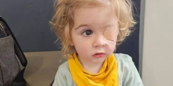 2 yaşındaki çocuk gözünden öpüldü, görme yetisini kaybetti: Uzman isimler nedenini açıkladı!