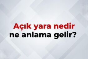 nedir (9)