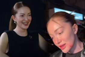 Danla Bilic darp sonrası ilk kez görüntülendi 'Fazlası var, eksiği yok'