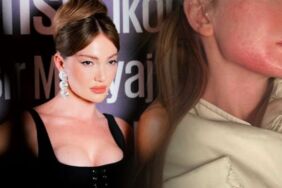 Danla Bilic'ten sarsıcı açıklama Eski sevgilisi tarafından darp edildi!