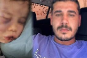 2 yaşındaki bebeği ısıran ve yakmaya çalış şahsın ifadesi ortaya çıktı!