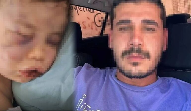 2 yaşındaki bebeği ısıran ve yakmaya çalış şahsın ifadesi ortaya çıktı!