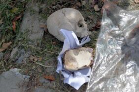 Çöp konteynerinde bulunan kafatasını kimin attığı belli oldu