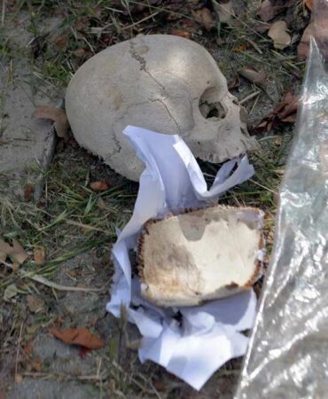 Çöp konteynerinde bulunan kafatasını kimin attığı belli oldu