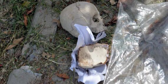 Çöp konteynerinde bulunan kafatasını kimin attığı belli oldu!