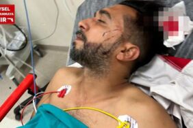 Adana’da dönercide dehşet Dürüm yerken başından vuruldu!