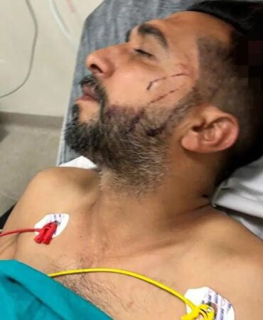 Adana’da dönercide dehşet Dürüm yerken başından vuruldu!