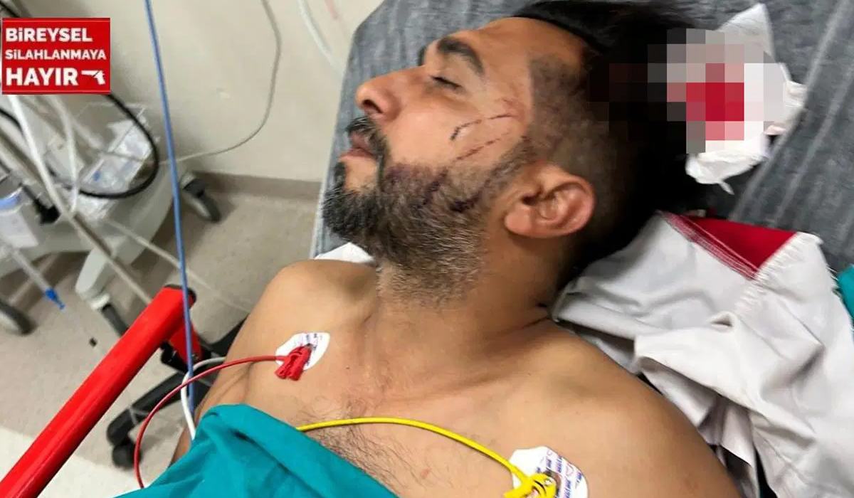 Adana’da dönercide dehşet Dürüm yerken başından vuruldu!