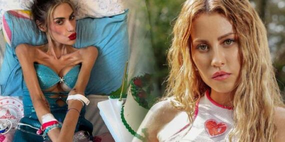 İlk kez anlattı: Nihal Candan’ın ölümü sonrası Derya Uluğ’dan ‘anoreksiya’ itirafı