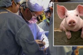 Domuzdan organ naklinde yeni umut Bağışıklık sisteminin haritası çıkarıldı!