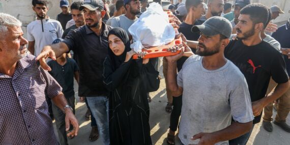 Gazze’de acı tablo: 114’ü çocuk 281 kişi açlık nedeniyle hayatını kaybetti!