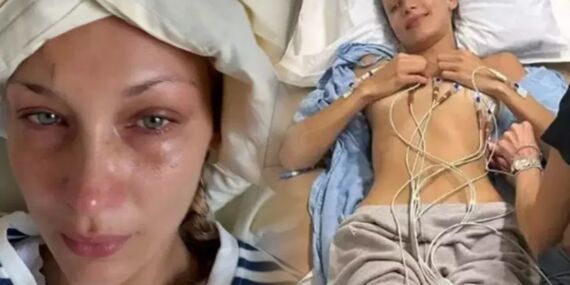 Sağlık sorunlarıyla mücadele eden Bella Hadid’den podyumlara görkemli dönüş!