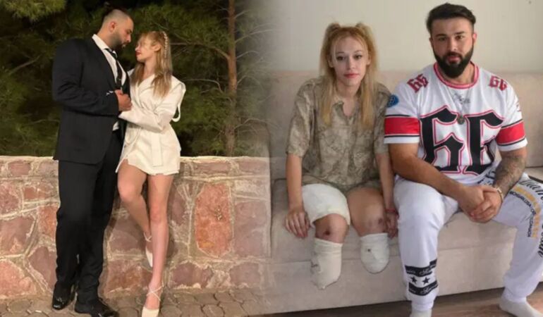 Evlilik yıl dönümü faciayla bitti Genç fitness eğitmeni İrem Karatutlu iki bacağını kaybetti