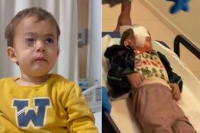 İnegöl’de torpil dehşeti 2 yaşındaki Alpaslan sağ gözünü kaybetti