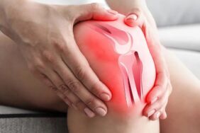 Menisküs yırtıklarında tedavi seçenekleri Hangi durumda ameliyat kaçınılmaz