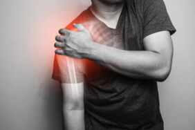 Omuzda ağrı ve güç kaybı neyin habercisi