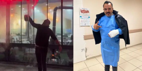 Soğuk havayı test etmek isterken kendini yaktı