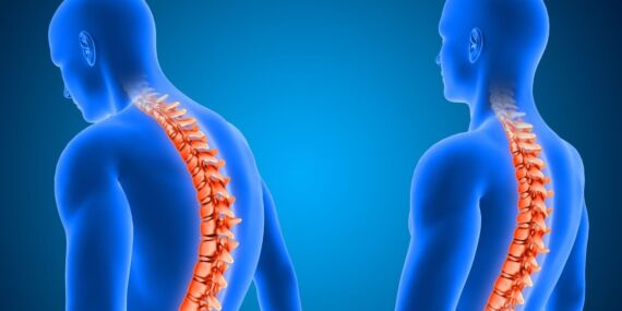 Uzun süre ekrana bakanlar dikkat! Uzmanı uyardı: ‘Gençler boyun fıtığının yeni hedefi’