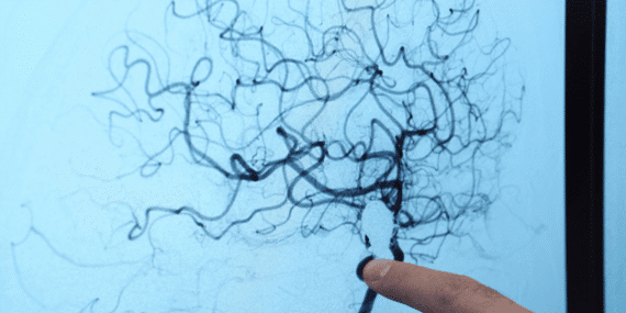 Her 20 kişiden biri risk altında: Uzmanlar bu hastalık için uyardı