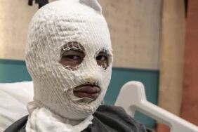 Çakmağını doldurmak isterken canından oluyordu