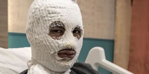 Çakmağını doldurmak isterken canından oluyordu