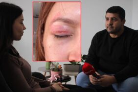 Güzellik salonunda yaptırdığı işlem kabusu oldu! 