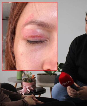 Güzellik salonunda yaptırdığı işlem kabusu oldu! 