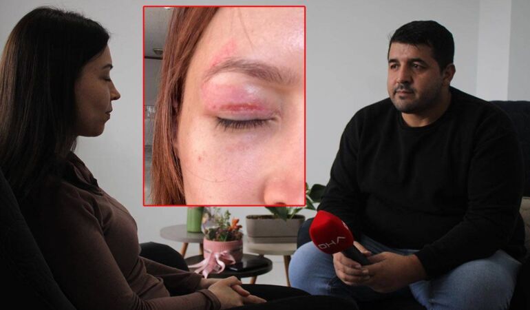 Güzellik salonunda yaptırdığı işlem kabusu oldu! 