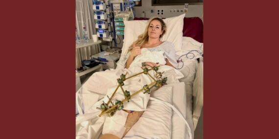 Kış Olimpiyatları’nda kaza geçiren Lindsey Vonn’dan sevindiren gelişme