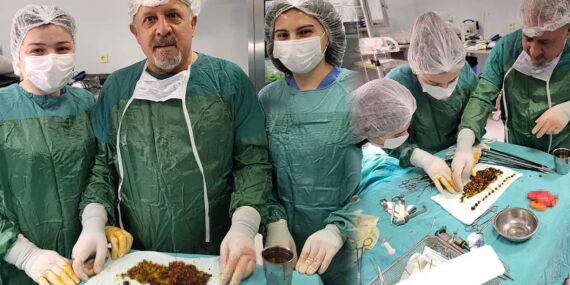 Doktorlar bile şaşırdı! ‘Safra kesesi ‘taş ocağı’ gibiydi’