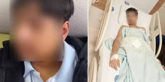 Okulda akran zorbalığı iddiası: 15 yaşındaki öğrencinin çenesi kırıldı