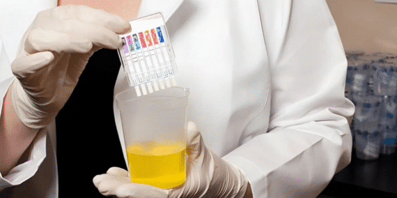 Stajyerlerden bile isteniyor… İşe alımlarda ‘uyuşturucu testi’ dönemi…