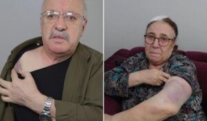 Yaşlı çifti sopa kırılana kadar darbettiler